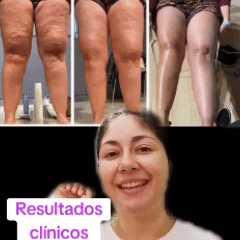 BYE BYE CELULITIS OFERTA LIMITADA X 2 UNIDADES + OBSEQUIO